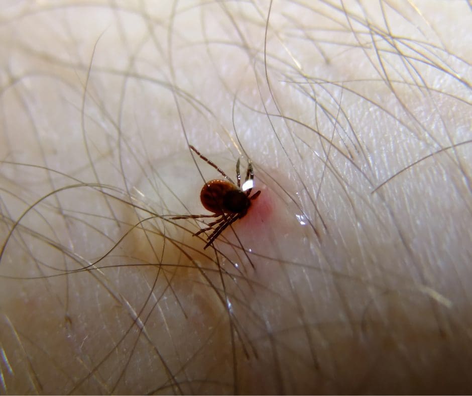 Tick Alert – check for bites as outdoor season begins.  